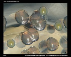 colony morphology of s.aureus and pseudomonas aeruginosa